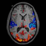 Imaging techniques such as fMRI measure blood flow through the brain.